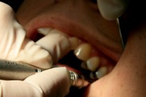 Illegal teeth whitening took place at golf club